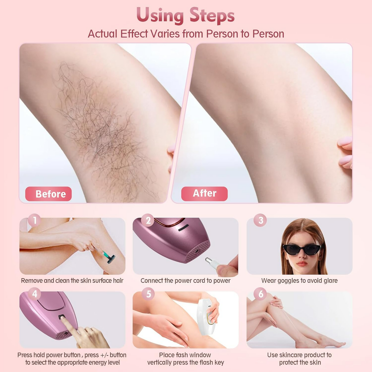 IPL Hair Removal Device