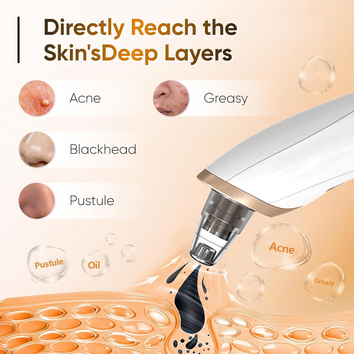 5-in-1 Blackhead Remover Facial Pore